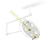 Медицинский хирургический светильник FotonFLY 5М
